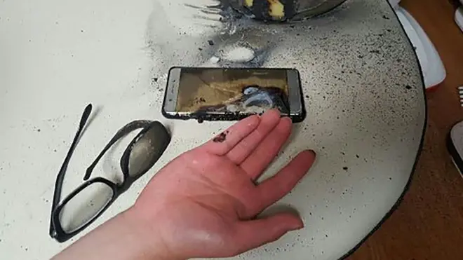 Во вторник японская полиция опубликовала снимок одного из пострадавших в результате возгорания аккумулятора