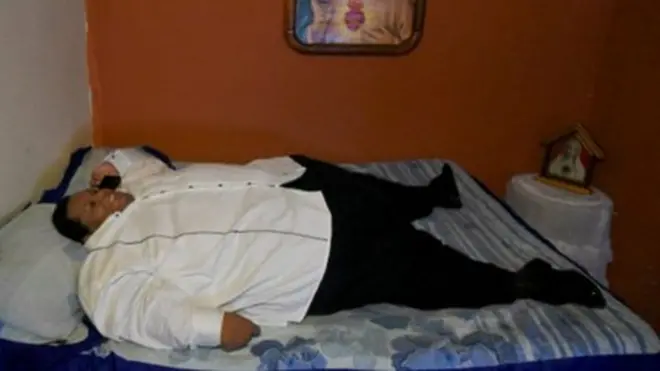 Aos 44 anos Óscar Vásquez Morales está preso a uma cama devido ao excessosorteio nomes roletapeso