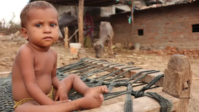 કુપોષિત બાળક