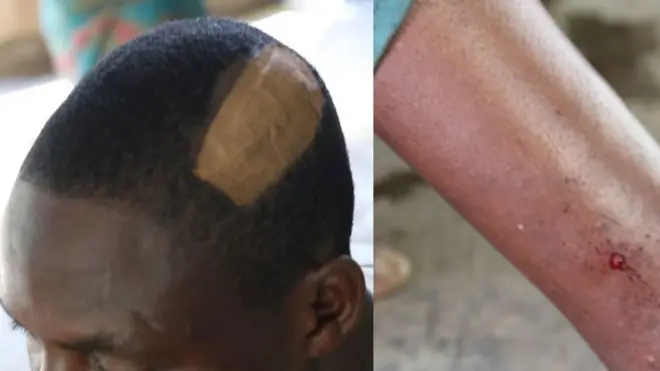 An araalu fara pa lasiko ti ẹlẹwọn Abolongo kọlu wọn