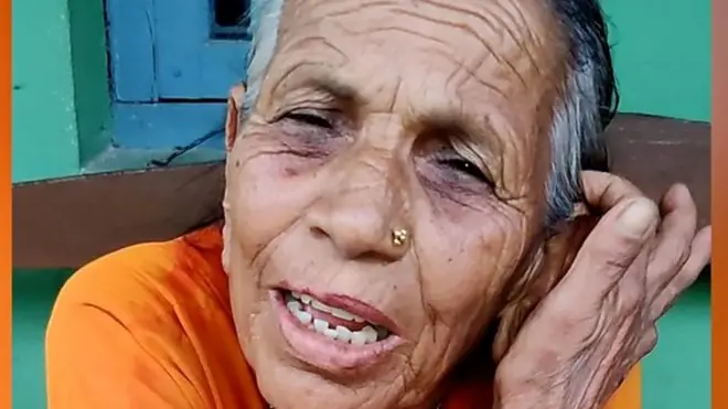 दोस्रो मात्राको पर्खाइमा रहेकी एक वृद्धा