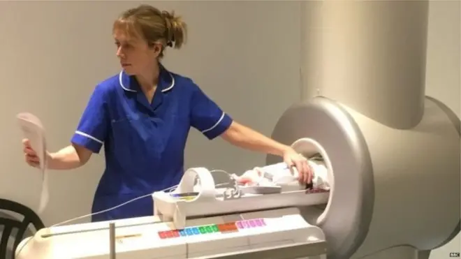 لا يتعدى حجم جهاز التصوير بالرنين المغناطيسي الخاص بالأطفال حجم الغسالة