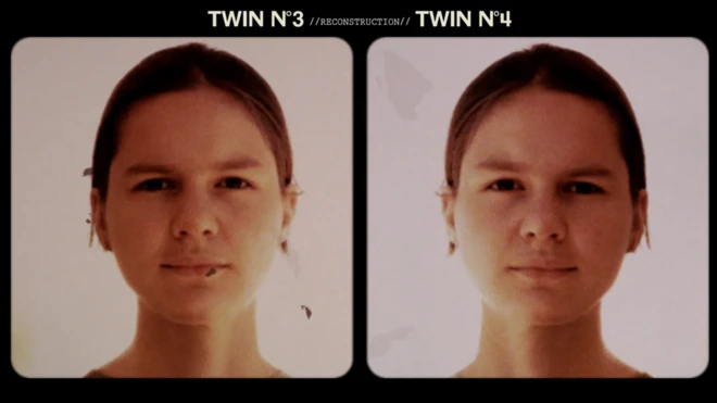 Gemelas separadas al nacer