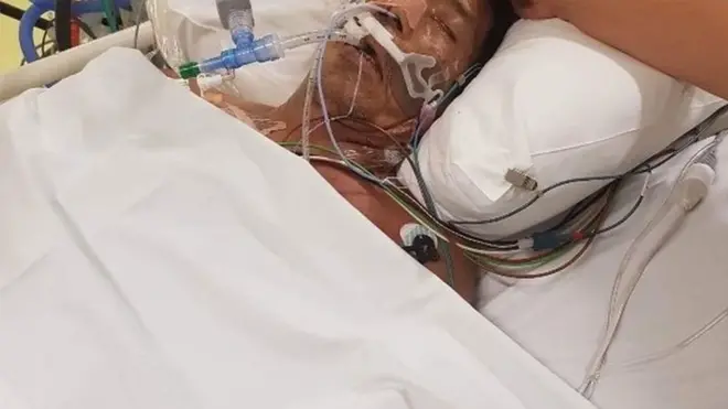 شقيقة المريض تقول إن شقيقها لا يزال باقٍ في غرفة العناية المركزة بالمستشفى