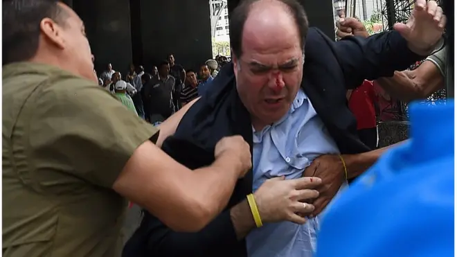 El jefe de la bancada opositora de Venezuela, Julio Borges, resultó herido durante la protesta.