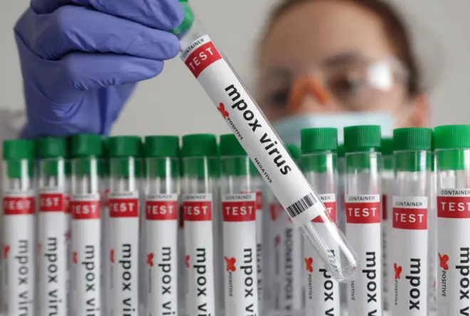Ọwọ kan to wọ ibọwọ mu igo kékeré kan ti wọn lẹ ọrọ "mpox virus" sara rẹ 