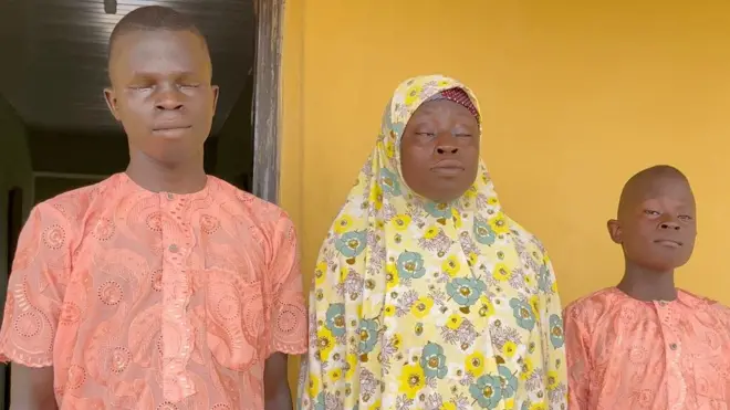 Obinrin to ni ipenija oju ati ọmọ rẹ meji ti wọn ko riran