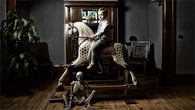 Maddox has a rare genetic disorder which is a perinatal form of hypophosphatasia