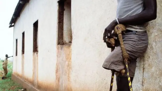 Ẹni ti ẹsẹ rẹ ge