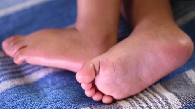 Ms Sultana had no idea she was pregnant with a set of twins