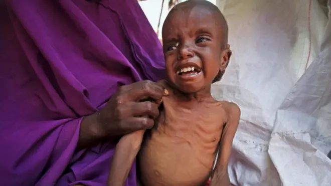 المجاعة في الصومال