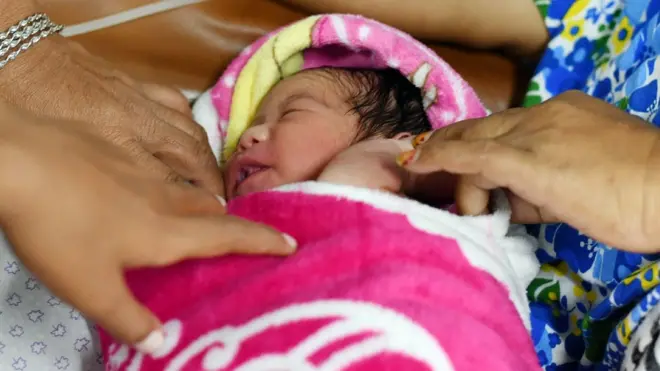 Las cesáreas pueden salvar vidas, pero también se corren riesgos innecesarios.,