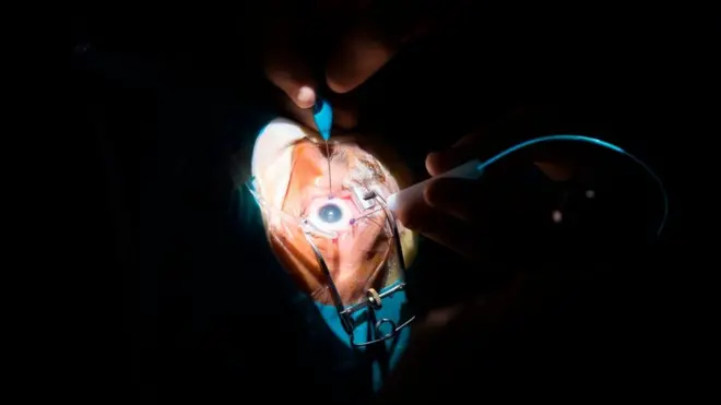 Wal'aansa baqaqsanii yaaluu wayita ijaaf taasifamu