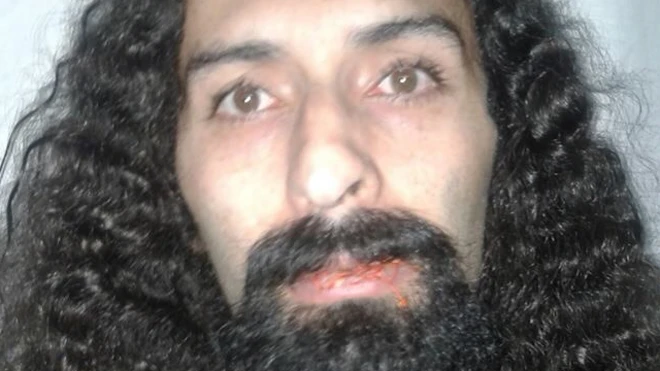 آقای شیرزاد در اعتراض لب‌هایش را دوخت