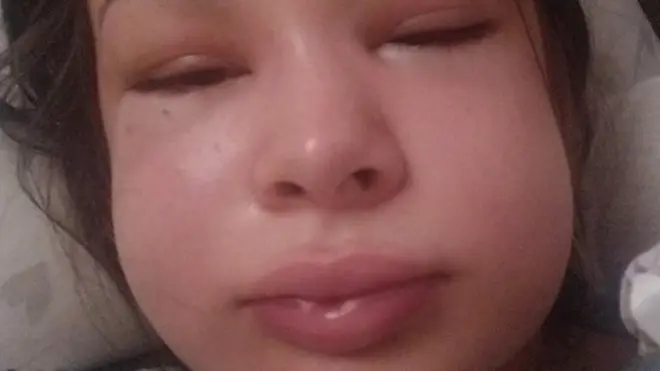 Pamela Andrade com inchaço no rosto