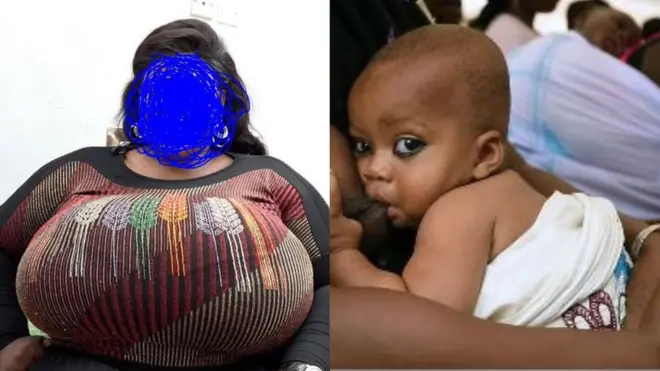 Aworan ọyan nla ati kekere