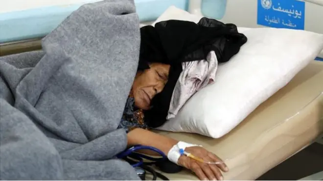 การขาดแคลนอาหารและการระบาดของอหิวาตกโรคซ้ำเติมสถานการณ์ในเยเมนให้เลวร้ายยิ่งขึ้น