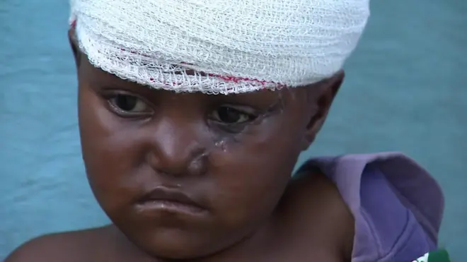 child in the drc ituri