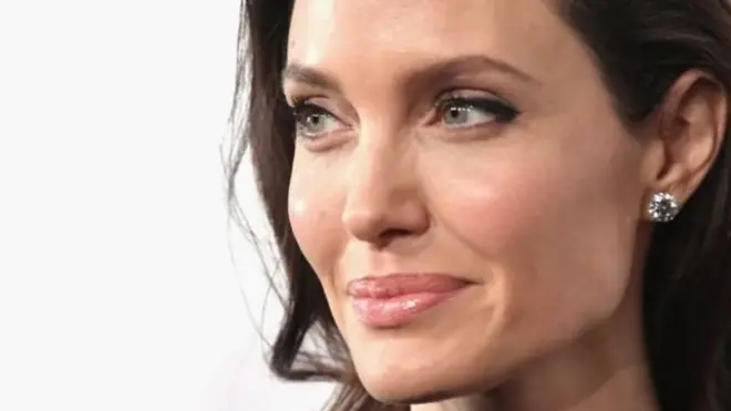 安吉丽娜•朱莉携带的这种基因叫做BRCA1（乳腺癌1号基因）