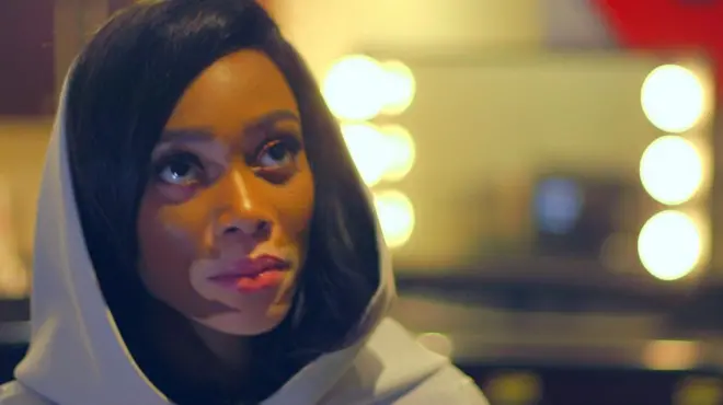 ဘီဘီစီရဲ့ အမျိုးသမီး၁၀၀ အထူးအစီအစဉ်အဖြစ် ၄ နှစ်သမီး အရွယ်ကတည်းက ခရုသင်း စွဲနေတဲ့ နာမည်ကျော် မော်ဒယ် Winnie Harlow ရဲ့ အကြောင်း။