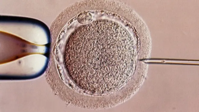 Dr Jan Karbaat dituduh diam-diam menggunakan spermanya sendiri dan bukan yang diminta para calon ibu.