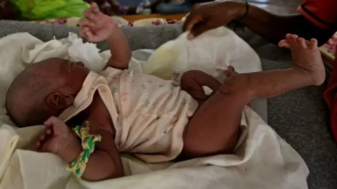 ኢትዮጵያዊ ህፃን