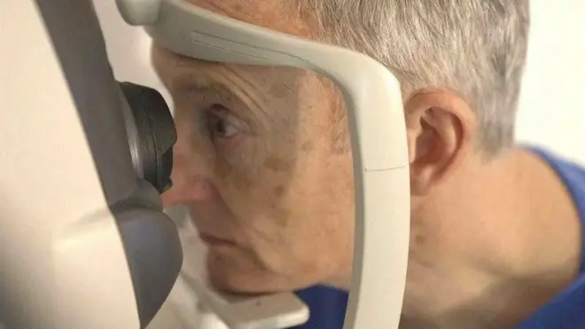 आँखा स्क्यान