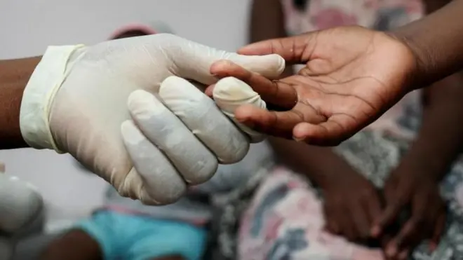 Une infirmière portant des gants prélève un échantillon de sang sur un enfant, pour un test de dépistage du VIH, sous le regard de la mère de l'enfant, dans une clinique de Diepsloot, au nord de Johannesburg, en Afrique du Sud, le 12 mars 2025.