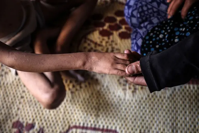 يد أم تمسك بيد طفلتها النحيلة نتيجة سوء التغذية، في ملجأ في وسط مدينة غزة 11 مايو/أيار 2025.