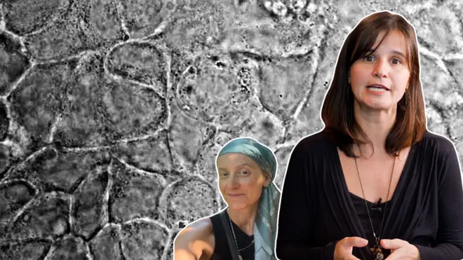 Repórter Mariana Alvim diante de imagem de célular cancerigenas e de paciente de câncer