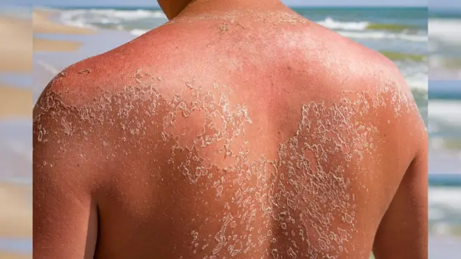 TikTok oo kansar lala xiriiriyey