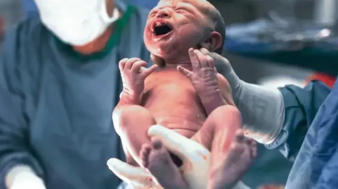 Naissance d'un bébé.