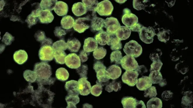 Naegleria fowleri
