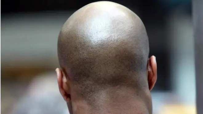 የመላጣ ሰው ጭንቅላት ከጀርባ