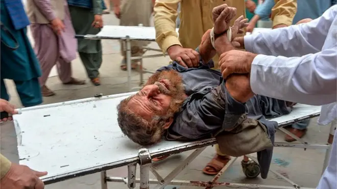 یوناما وايي، موندنې یې ښیي چې په دې پېښه کې لږ تر لږه ۶۳ تنه وژل شوي او ۴۶ تنه نور ملکیان ژوبل شوي دي.