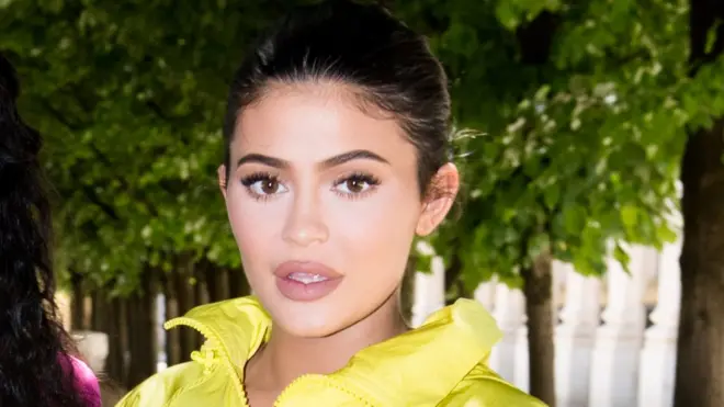 Kylie Jenner has removed her famous lip fillers