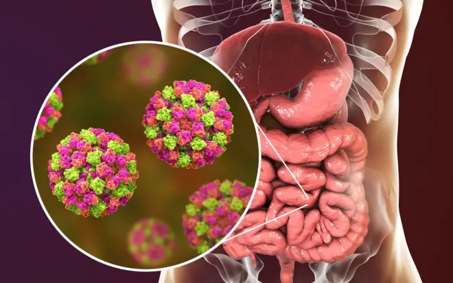 norovirus