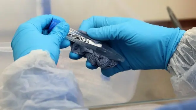 کورونا ٹیسٹ