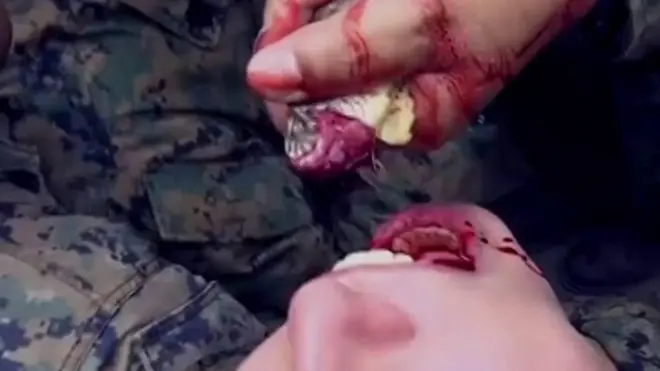 ደም ተመን ከመይ ከምዝስተ፣ ጥንቅርብዒት ከመይ ከምዝብላዕን ዝመሃሩ ወተሃደራን ኣሜሪካን ደቡብ ኮርያን