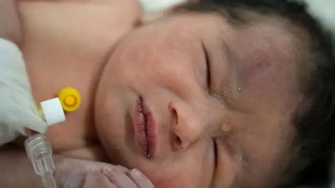 지진 잔해서 구조된 신생아