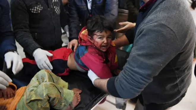 طفل جريح في أعقاب غارة جوية تركية على قرية في منطقة عفرين أمام مشفى عفرين مع أسرته لتلقي العلاج