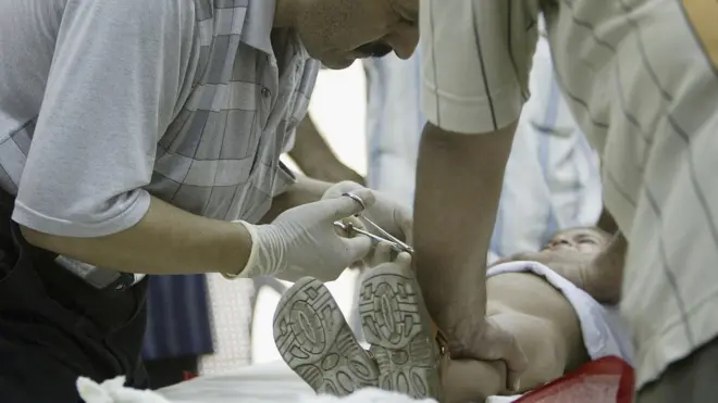 การขริบอวัยวะเพศชาย