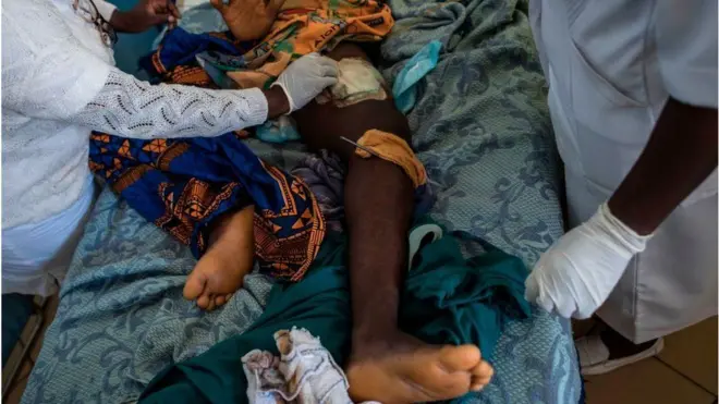 Pesin wit gunshot wound for Nigeria hospital