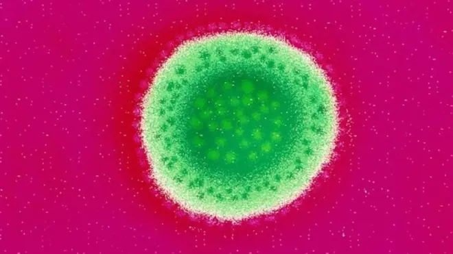 "حمى لاسا" المرض القاتل