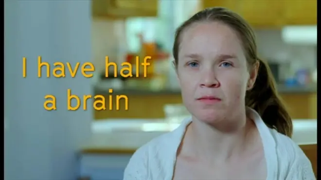 幼少時にラスムッセン脳炎という非常に稀な病気を患い、右脳の摘出手術を受けたジョディさんは現在、「普通の人と変わりない」と話すほど元気だ。