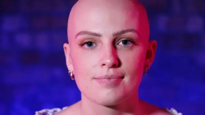 کچھ لوگ کم عمری میں ہی گنج پن کا شکار کیوں ہوجاتے ہیں؟