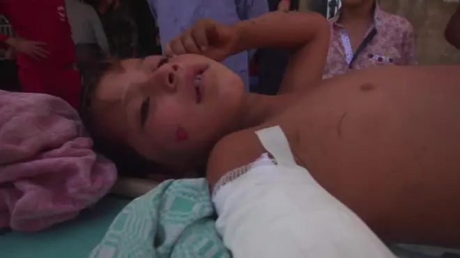 Halep'te yaralı bir çocuk