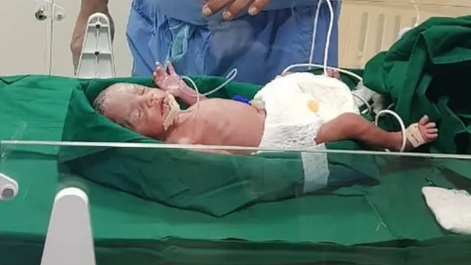 'राधा' की पहली तस्वीर