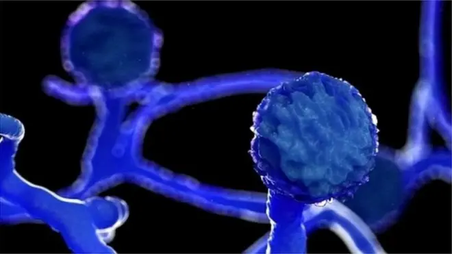 ब्लैक फ़ंगस