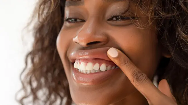 Une femme montre ses gencives.